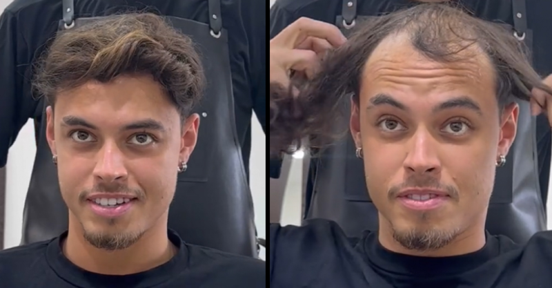 Kerel weet zijn kaalheid perfect te camoufleren met eigen haar (video)