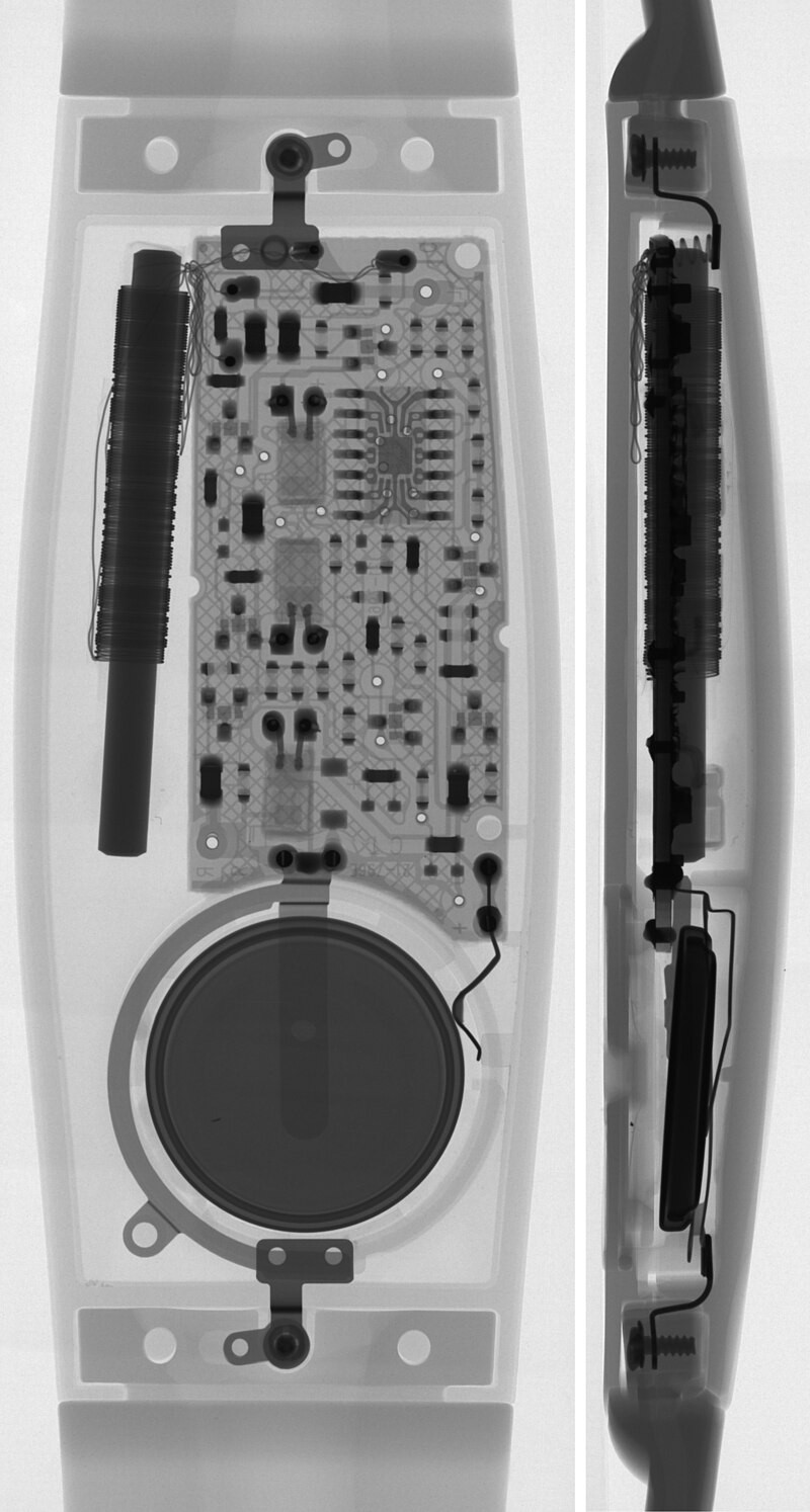 Haperende hartsensor Philips: mogelijk twee doden in VS, ruim honderd met verwondingen