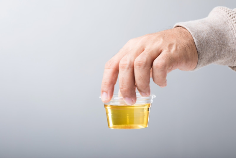 Urine is het nieuwe goud: wetenschappers ontdekken waardevolle toepassing voor je plasje