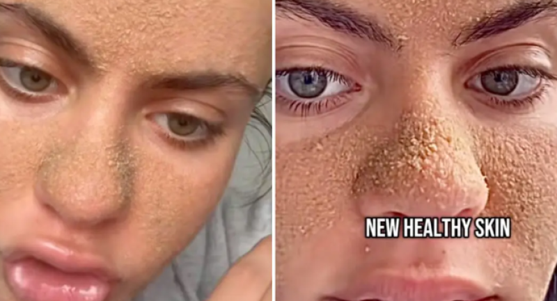 🎥 Van glow-up naar groezelig: de smerige waarheid achter de nieuwste skincare-hype op TikTok
