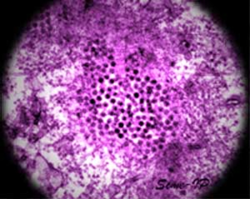 Italië: minstens acht doden door tropisch virus dat wordt overgedragen door muggen - 57 nieuwe besmettingen
