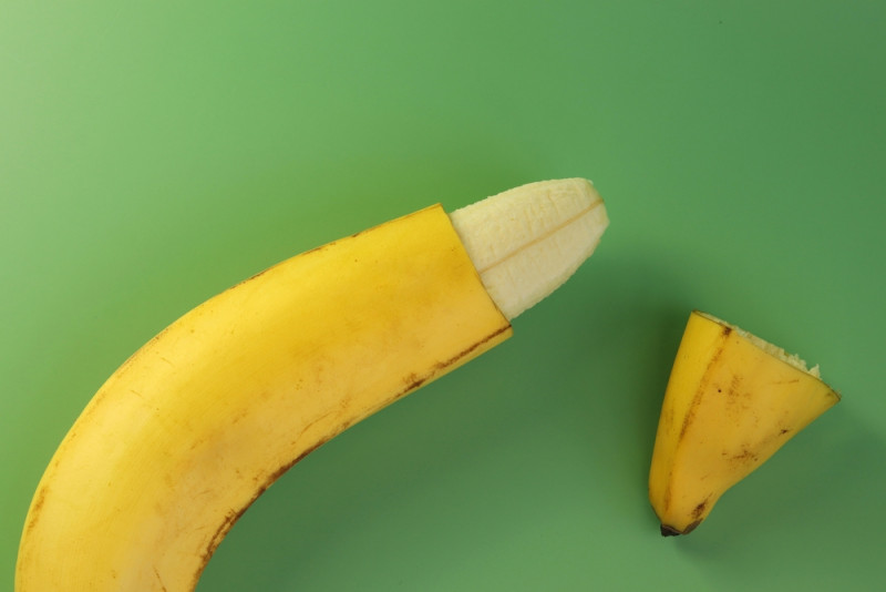 Wie het velletje van zijn jonge heer wil laten weghalen, zal dat straks zelf mogen betalen