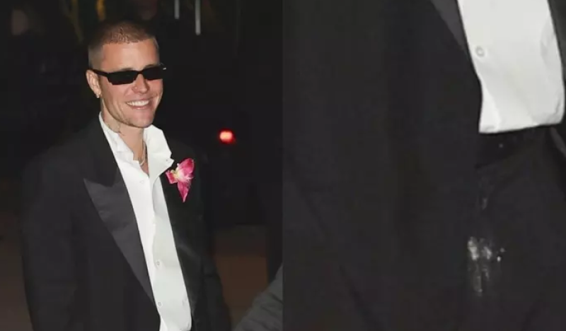 📸 Justin Bieber daagt op het feestje van het jaar met verdacht wit poeder op zijn broek