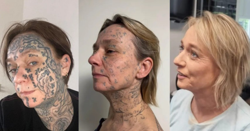 Succesvolle crowdfunding voor vrouw die door ex 250 keer werd getatoeëerd