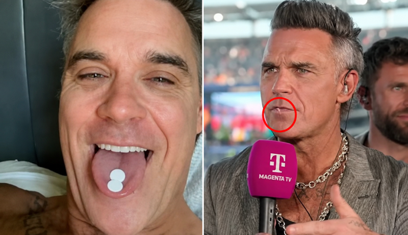 🎥 Wat floepte er uit de neus van Robbie Williams? Of kwam het uit zijn mond?