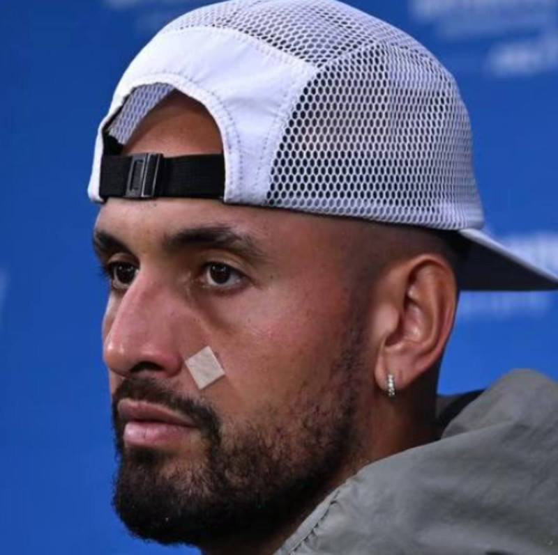 📸 De vrije val van Nick Kyrgios: tennisenfant terrible test positief op cocaïne