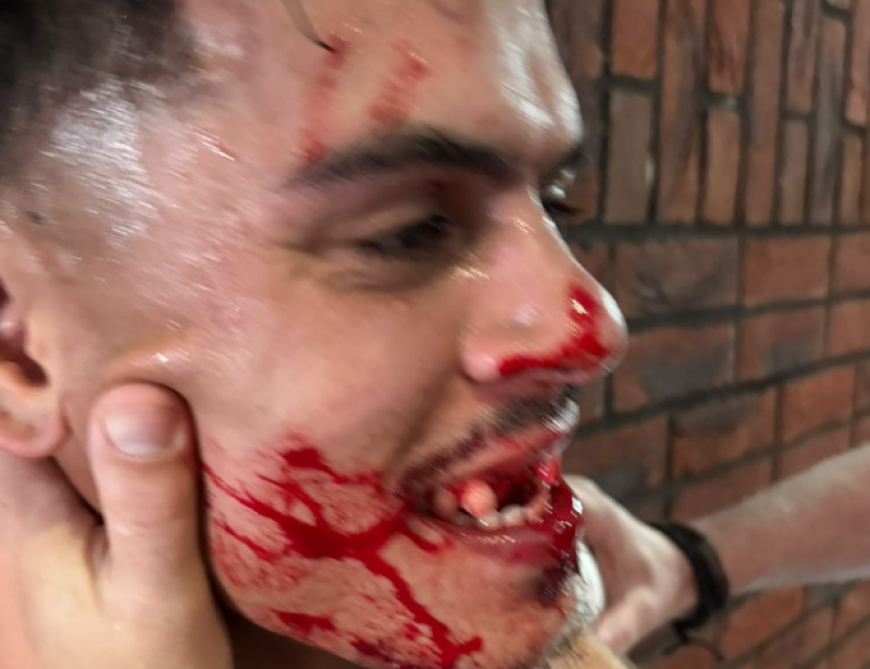 📸 Vijf hechtingen en zeven tanden kwijt: Nederlandse voetbalderby ontaardt in bokswedstrijd