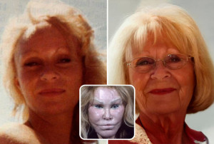 image Jocelyn-Wildenstein-81-jaar in CelebsNaturel gallery