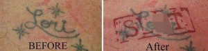image 7 in extattoos gallery