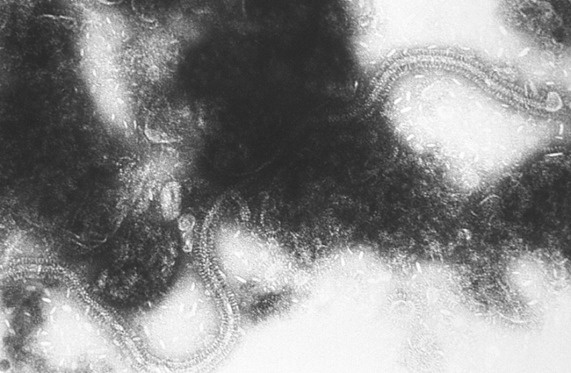Lijdensweg van RSV-vaccin in schril contrast met succes coronavaccin