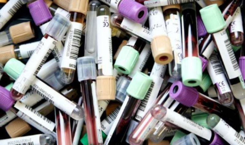 Volgt overdracht coronavirus principes van bloedtransfusie?
