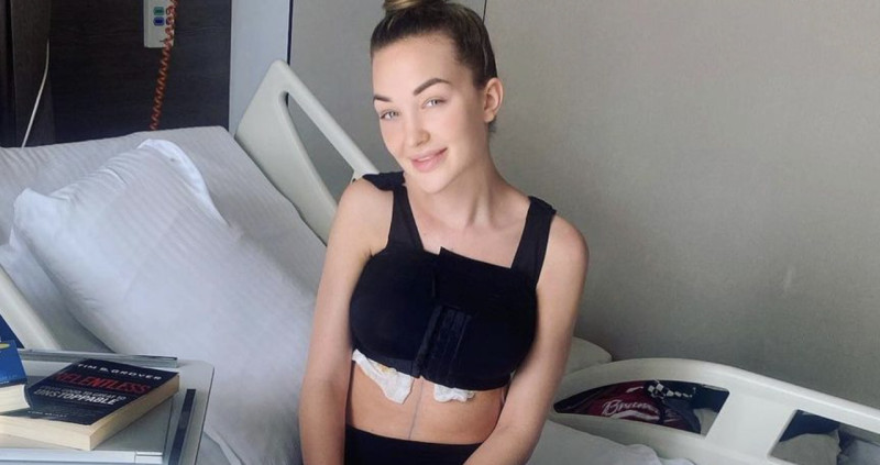 Miss België deelt haar borstvergroting op Instagram (foto’s)